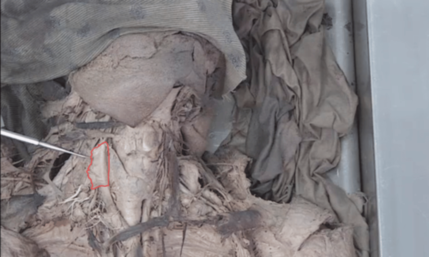 <p>identify this fascia</p>