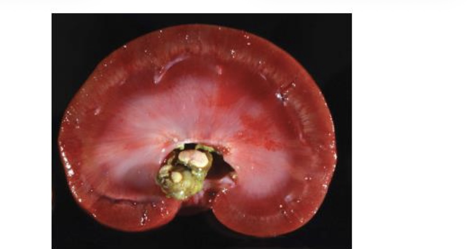 <p>what type of calculi is this?</p>