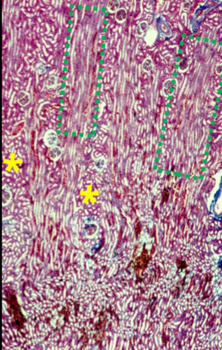 <p>straight tubules and collecting ducts (green boxes)</p>