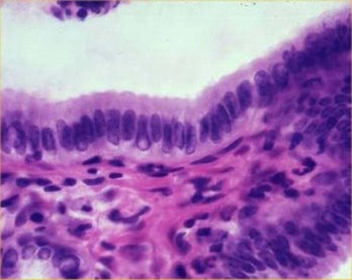 <p>the connective tissue to this slide is dense irregular:</p>