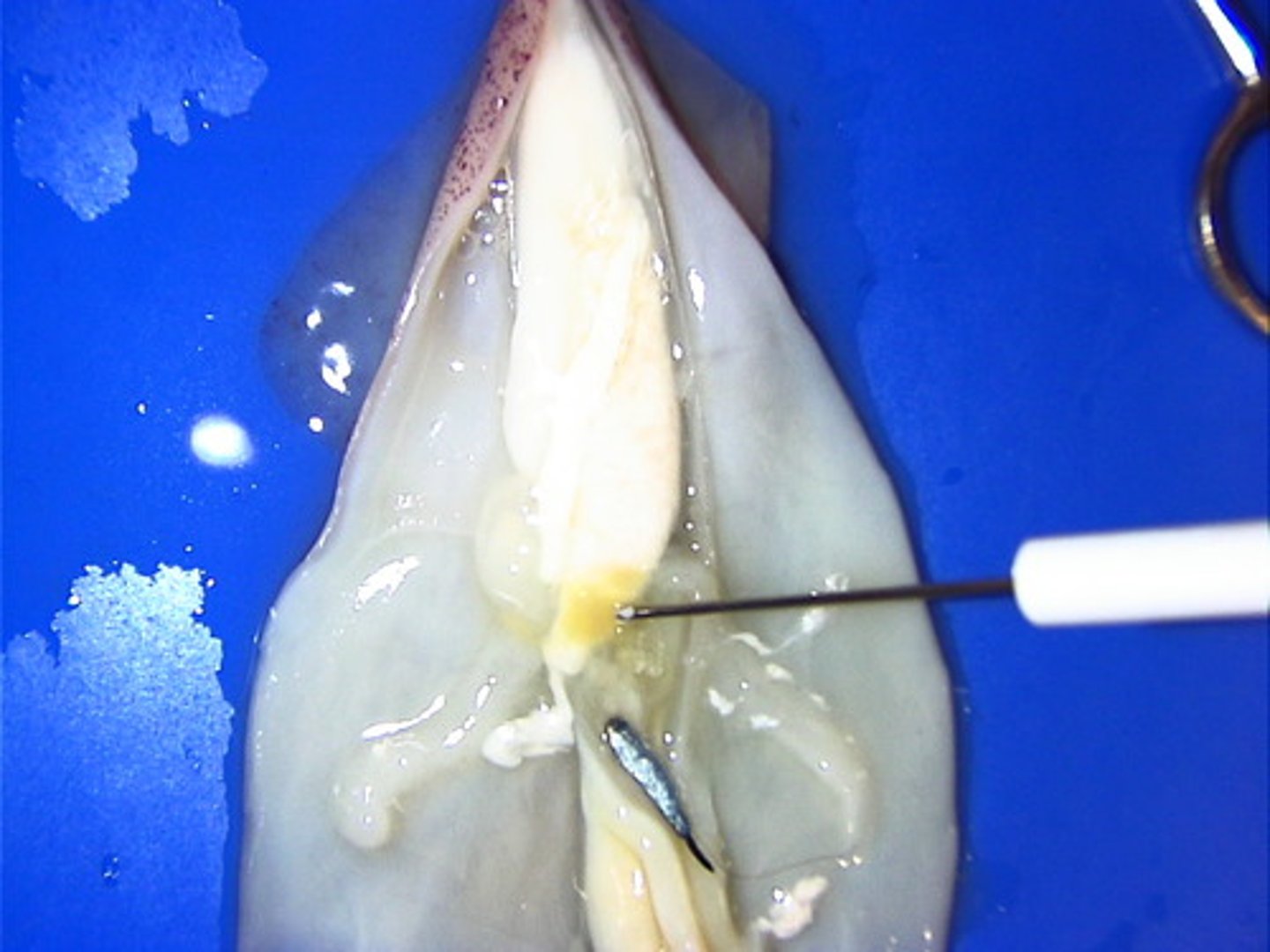 <p>larger heart that pumps blood throughout the body.</p>