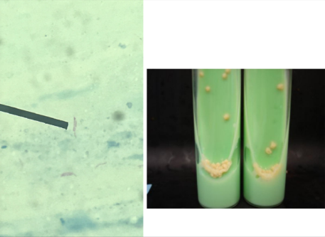 <p>What makes the culture medium in the set up selective to this organism?</p>