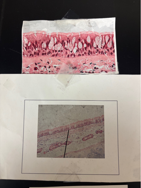 <p>What kind of tissue/cartilage is this?</p>