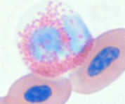 <p>What WBC is this?</p>