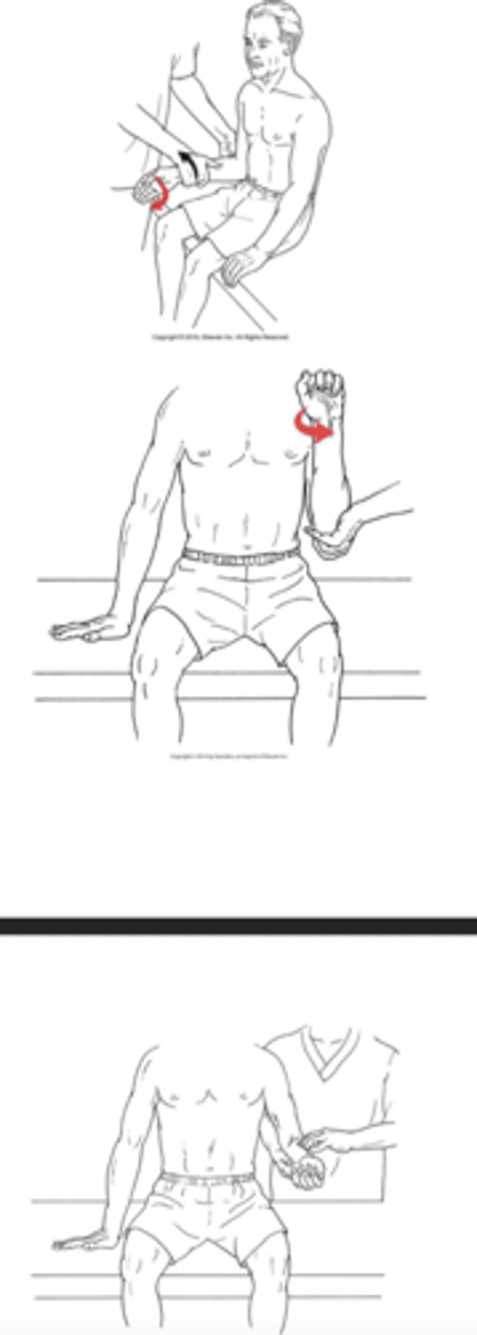 <p>What test is being performed in the image?</p>