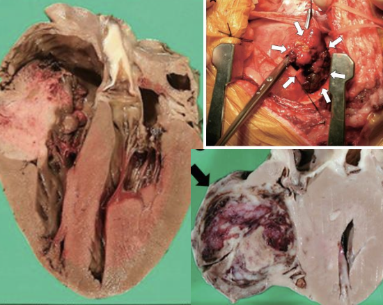 <p>infrequent in dogs, overall incidence of 0.19%</p>