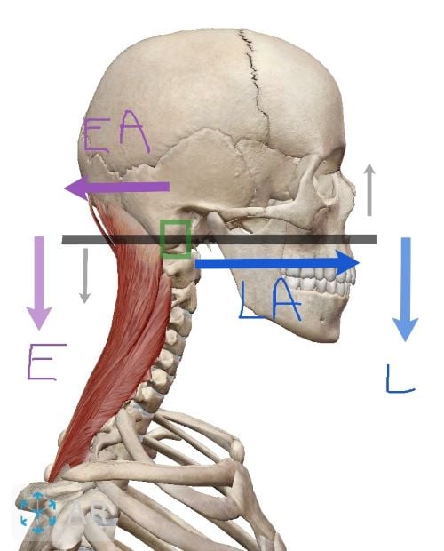 <p>fulcrum inbtwn AF and FR. MA or KA. ex: head and neck extension</p>