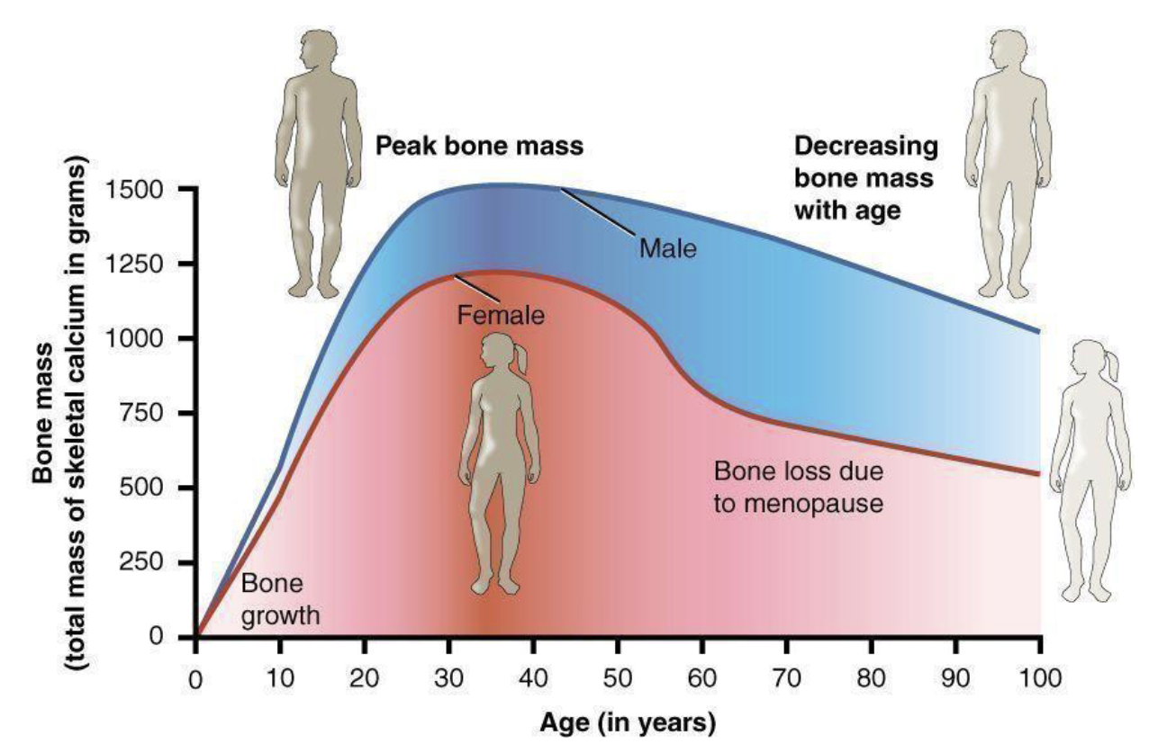<p>Early menopause = low estrogen</p><p>Eating disorders</p><p>Family hisotry of osteoporosis</p><p>Early malnutrition</p><p>Vitamin D deficiency</p>