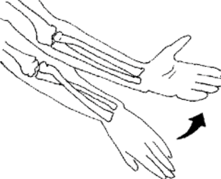 <p>The motion shown below is</p>