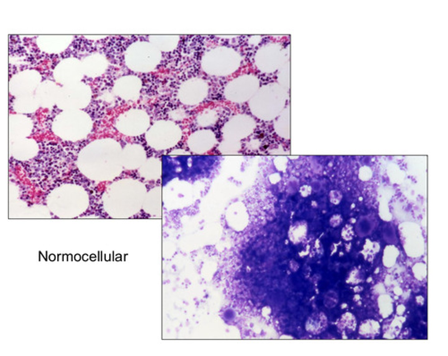 <p>Close to a 1:1 ratio of hemic to fat cells</p>