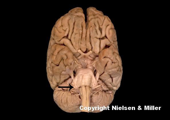 <p>what is this indicated nerve</p>