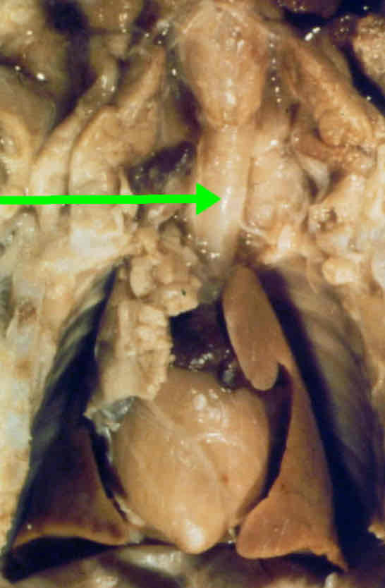 <p>Identify this structure</p>