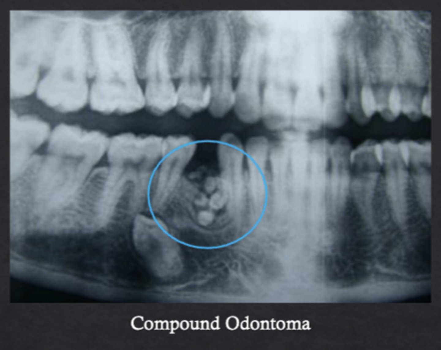 <p>Forms multiple small tooth-like structures with recognizable layers of dental antomy</p>