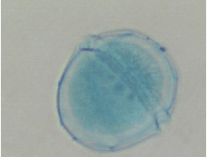 <p>What phylum does Peridinium belong to?</p>