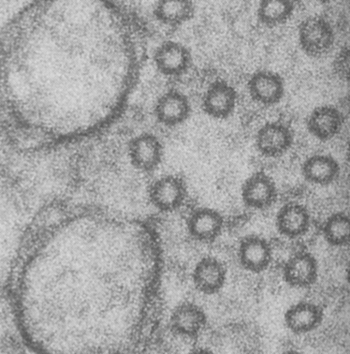 <p>what are the smaller circles in this image</p>