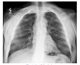 <p>What projection is this?</p>