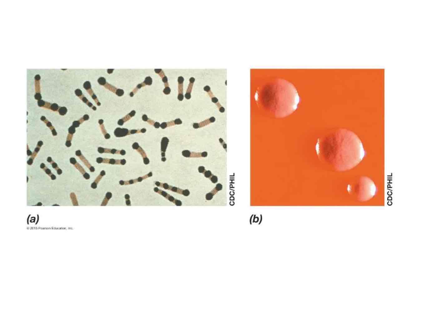 <p><em>Corynebacterium diphtheriae </em>produces an exotoxin inhibiting protein synthesis, causing tissue death in the respiratory tract, i.e. diphtheria, leading to death by suffocation</p>