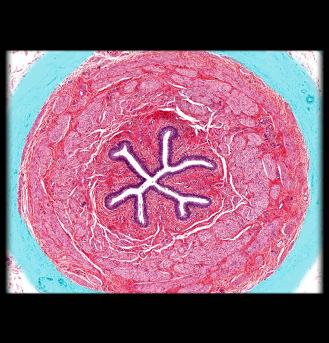 <p>Outer fibrous connective tissue anchoring ureter in place</p>