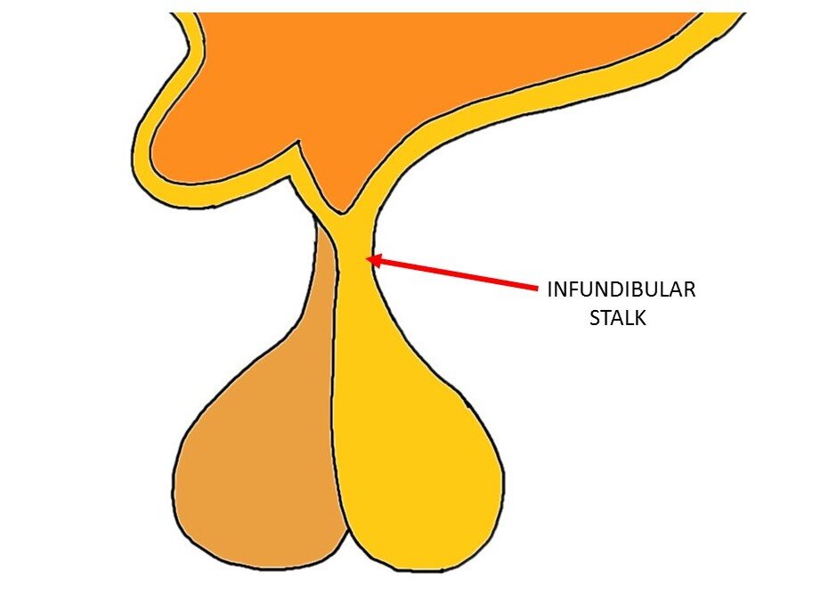 <p>a funnel shaped cavity or structure — the hollow stalk that connects the hypothalamus and the posterior pituitary gland</p>