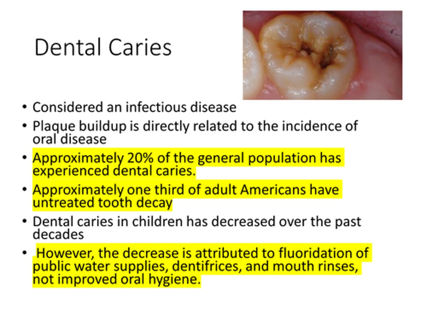 <p>c. The first statement is true, the second statement is false.</p><p>TRUE - Dental caries in children has decreased over the past decades</p><p>FALSE - However, the decrease is attributed to fluoridation of public water supplies, dentifrices, and mouth rinses, not improved oral hygiene.</p>