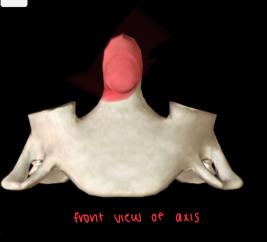 <ul><li><p>ONLY IN CERVICAL VERTEBRAE </p></li><li><p>Looks like a HEAD on anterior view</p></li></ul><p></p>