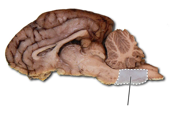 <p>Name the part of the brain that is highlighted.</p>