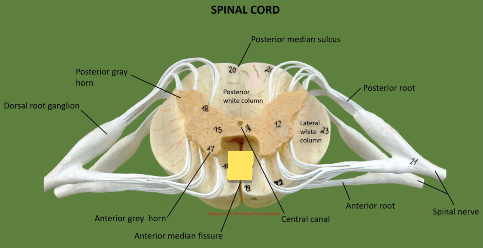 <p>Name this spinal cord part</p>