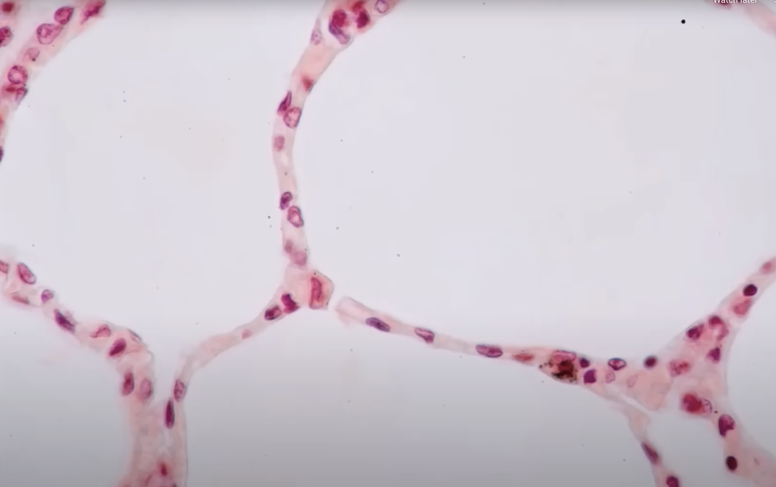 <p><strong>Simple Squamous Epithelium</strong></p><p>Location: <strong><u>Lining body cavities</u></strong></p><p>Function: <strong><u>Diffusion</u></strong></p><p>( simple squamous are very thin cells — <u>thinner</u> <u>cells</u> = <u>faster rate of diffusion</u> )</p><p>-</p><p><strong>Simple Squamous Epithelium</strong></p><ul><li><p>One layer</p></li><li><p>Flat &amp; <u>squished</u></p></li><li><p>Round nuclei (but may look squished)</p></li></ul><p></p>