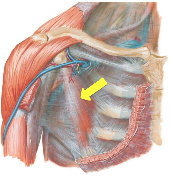 <p>Pectoralis Minor</p>