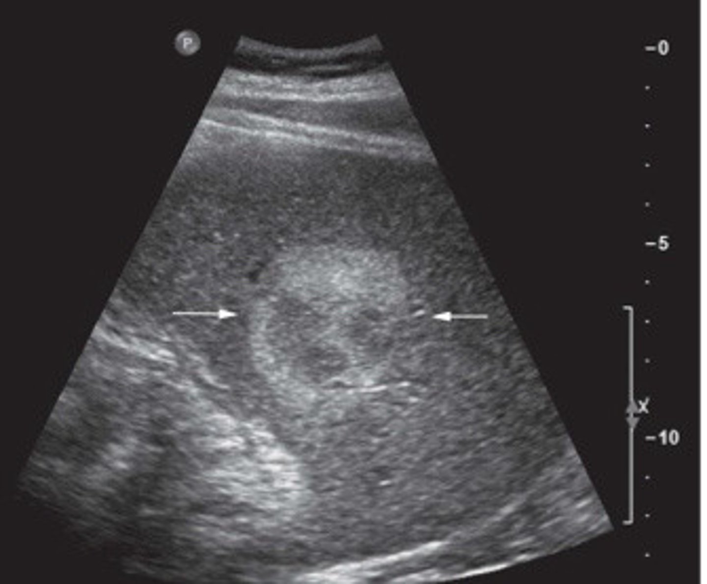 <p>What does this image show</p>