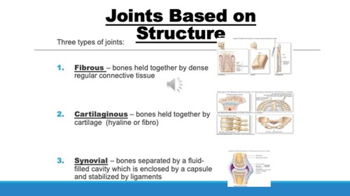 <p>a way to categorize joints by the material that holds the bones of the joints together. They include; fibrous, cartilaginous, &amp; synovial.</p>
