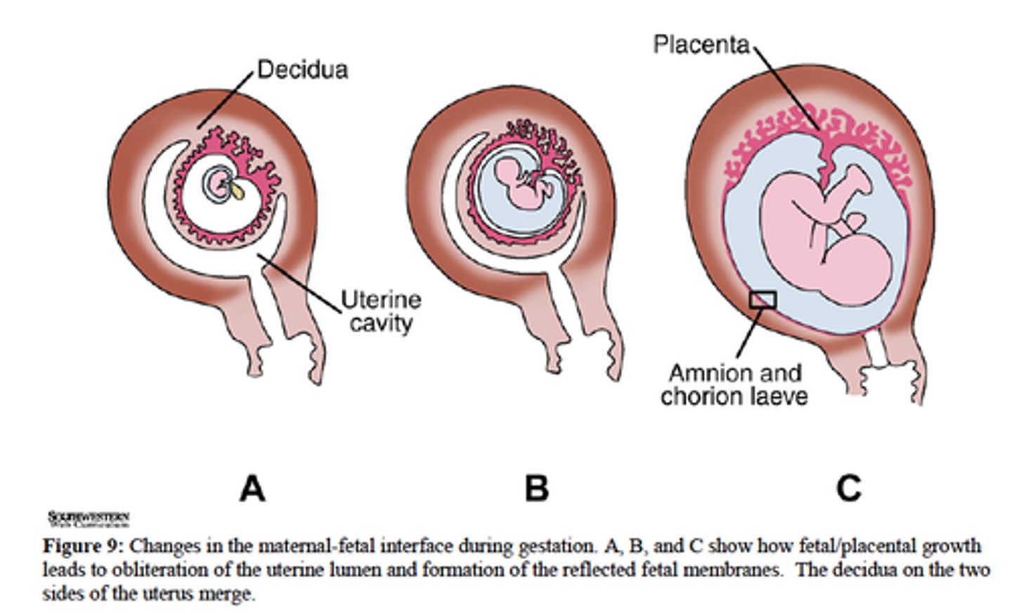 <p>discharge of amniotic fluid</p>