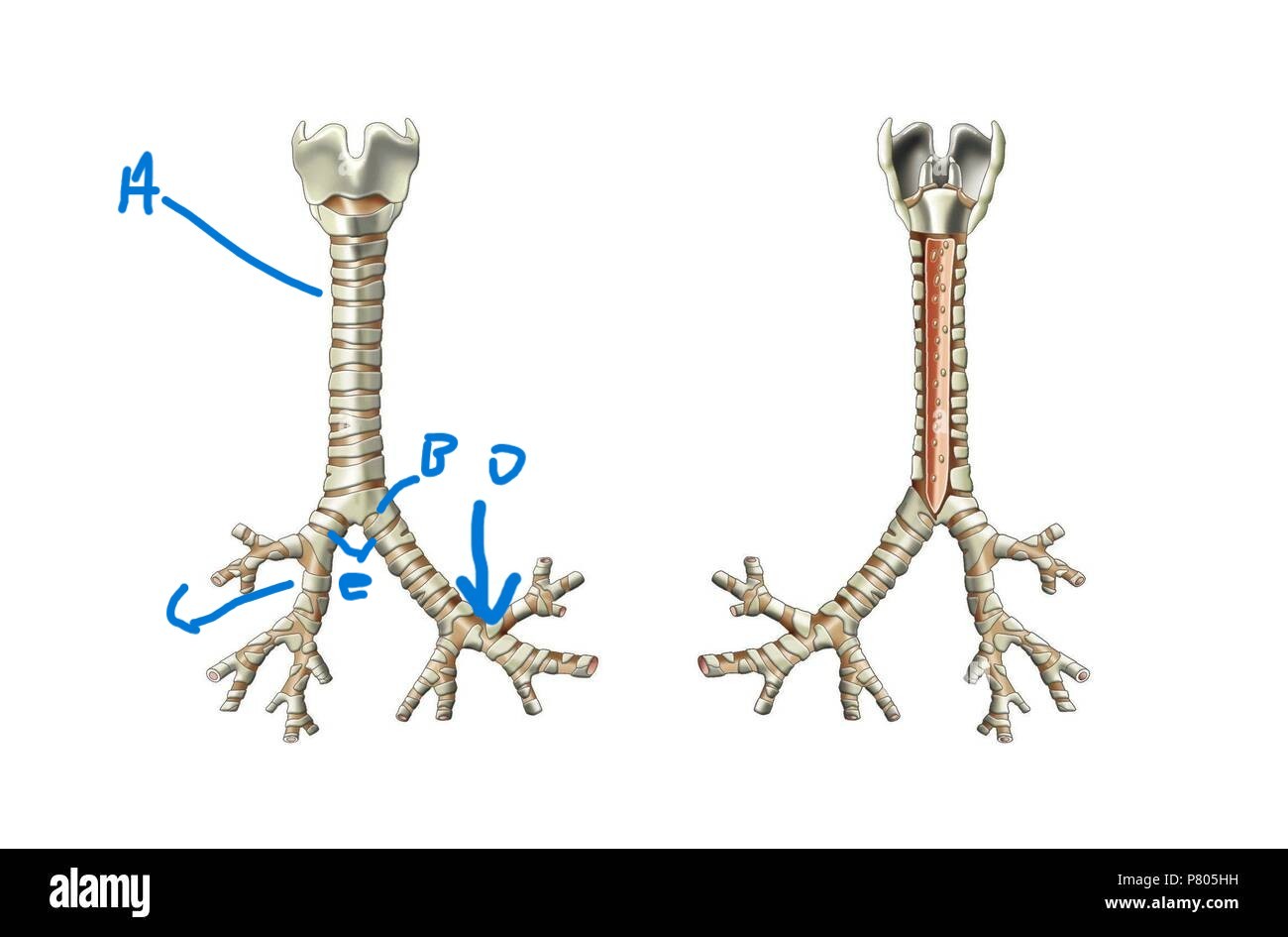<p>Trachea (A)</p>