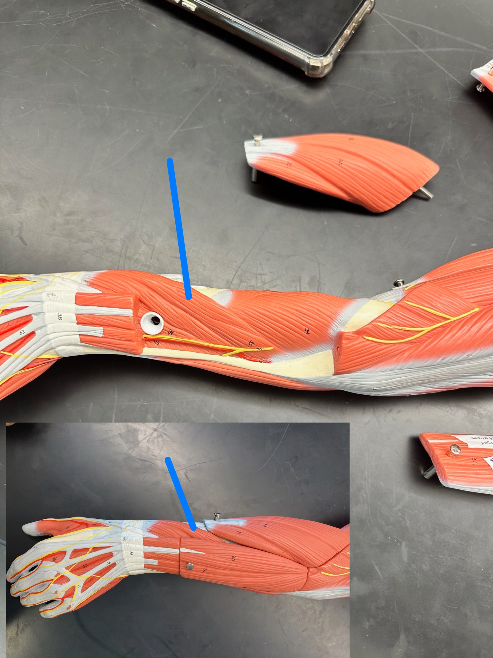<p>ID muscle</p>