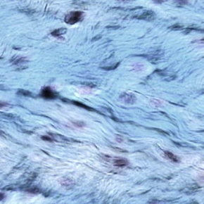 <p>Identify this connective tissue, its location, and its function.</p>
