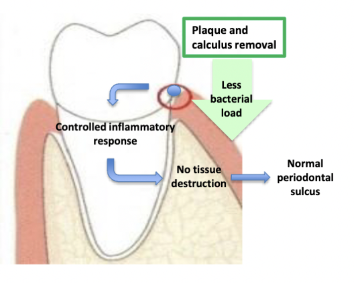 <ul><li><p>brushing</p></li><li><p>flossing</p></li><li><p>prophylaxis</p></li></ul><p><span>Decreasing bacterial load disrupts positive feedback loop</span></p>