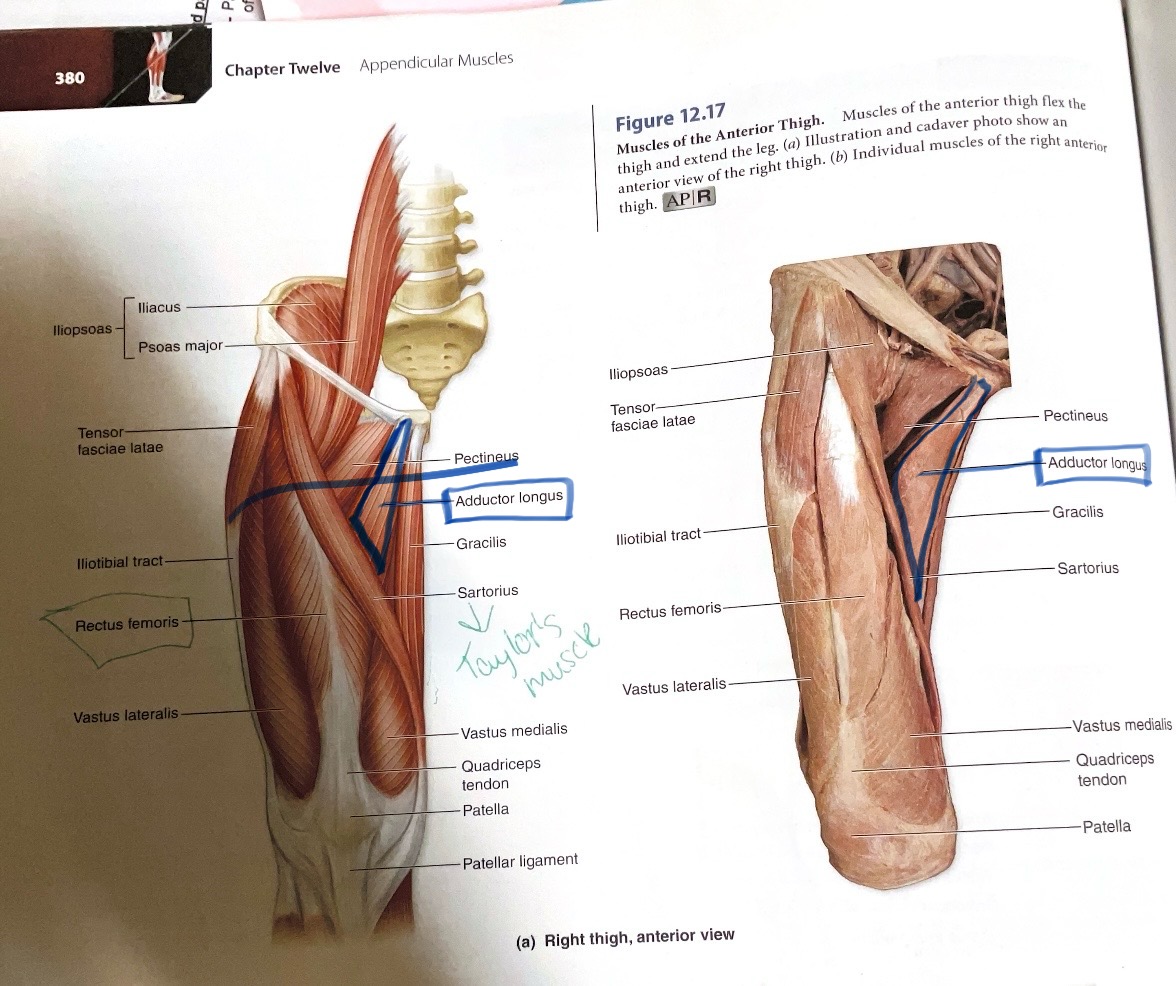 <p>Origin: Anterior body of pubis</p><p>Insertion: Linea aspera</p><p>Action:Adduct hip</p>