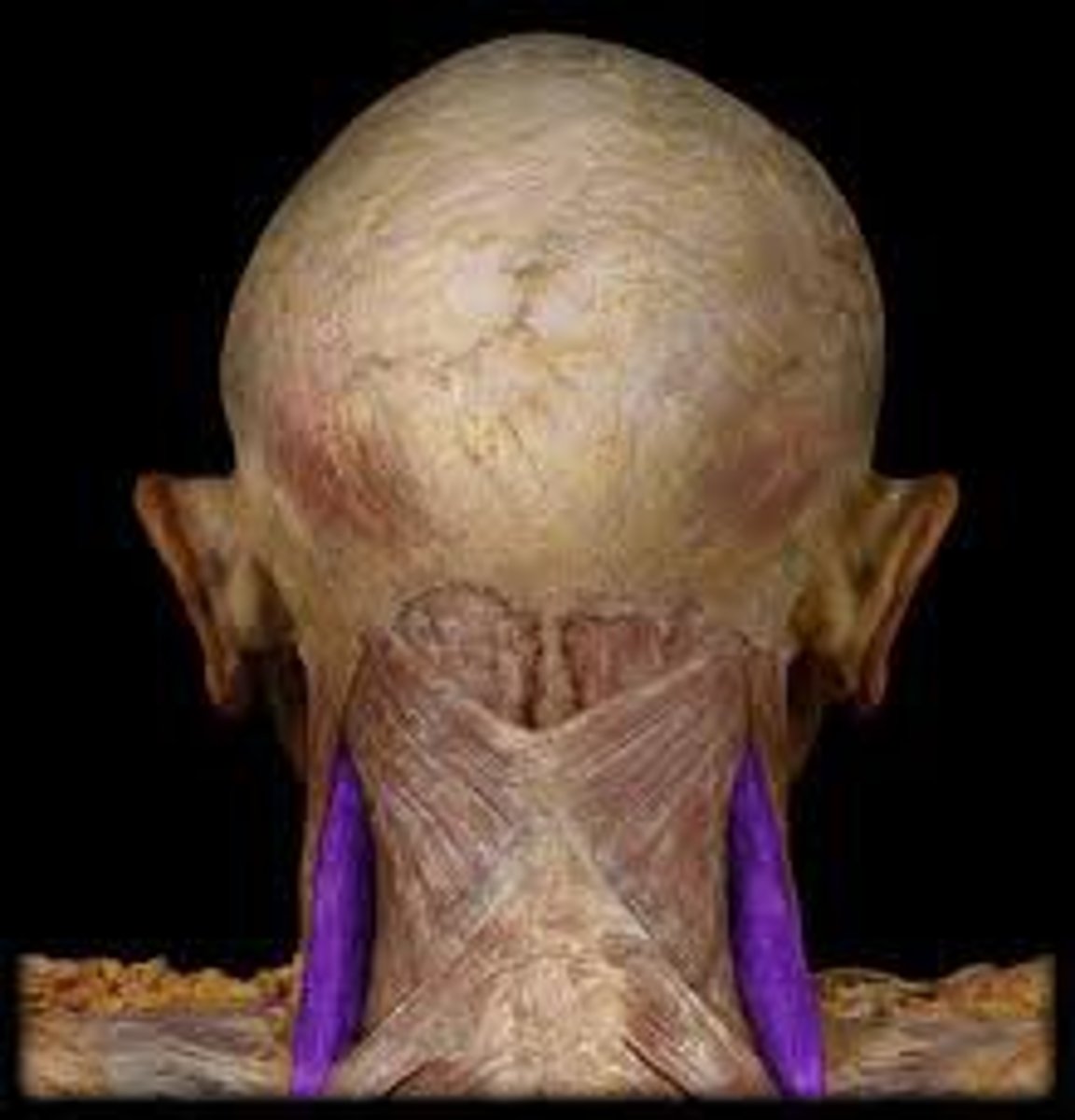 <p>Origin: Transverse processes of vertebrae C1-C4 Insertion: scapula</p><p>Action: Elevates scapula; flexes neck laterally</p>