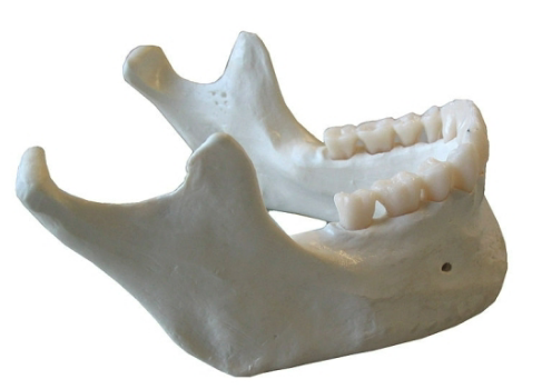 <p>Lower jawbone, largest &amp; strongest facial bone</p>
