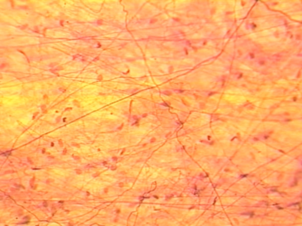 <p>Areolar Tissue</p>