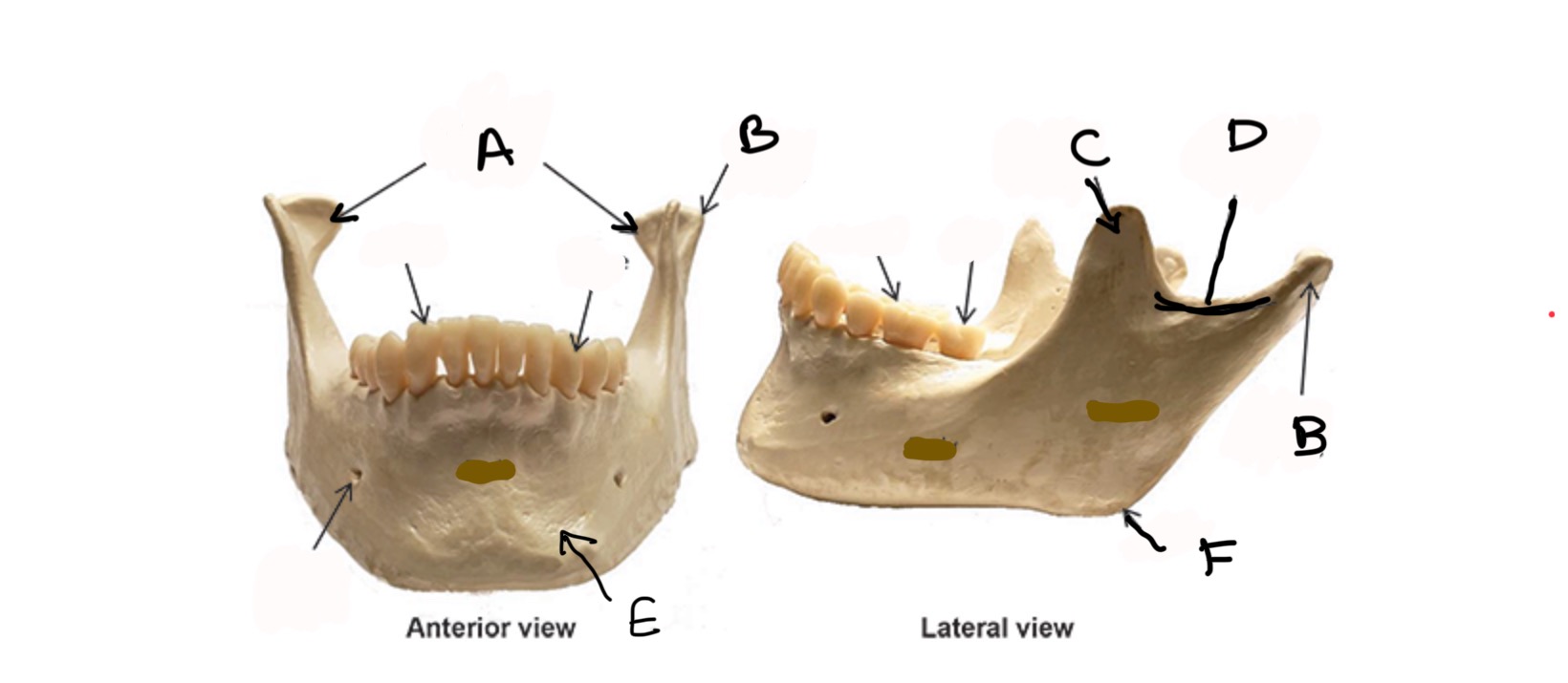 <p>Type of Bone: Mandible</p><p>What is C?</p>