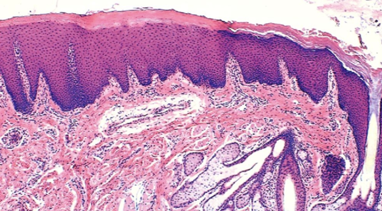 <p>Specify the type of epithelium and if it is keratinized or non-keratinized</p>
