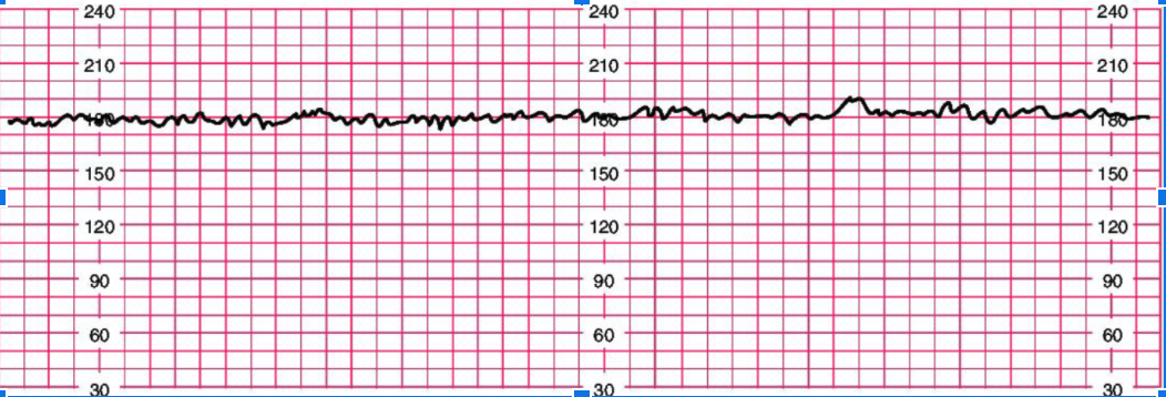<p>explanation of FHR strip</p>