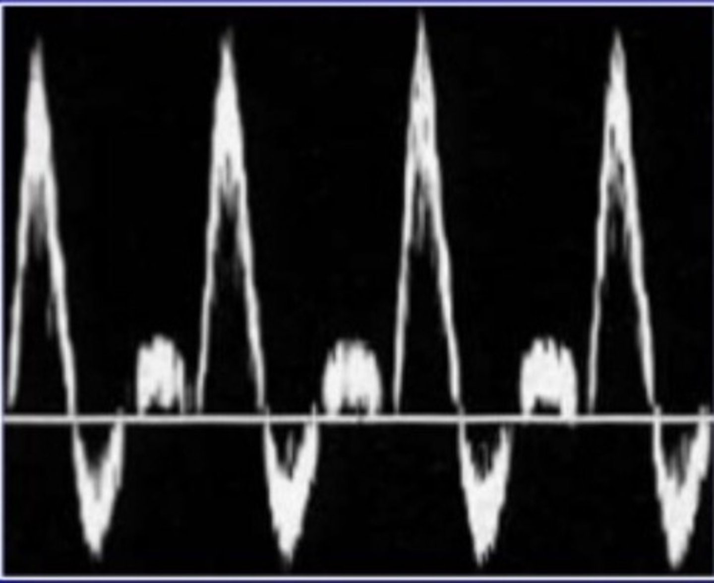 <p>vascular flow yielding three phases</p>