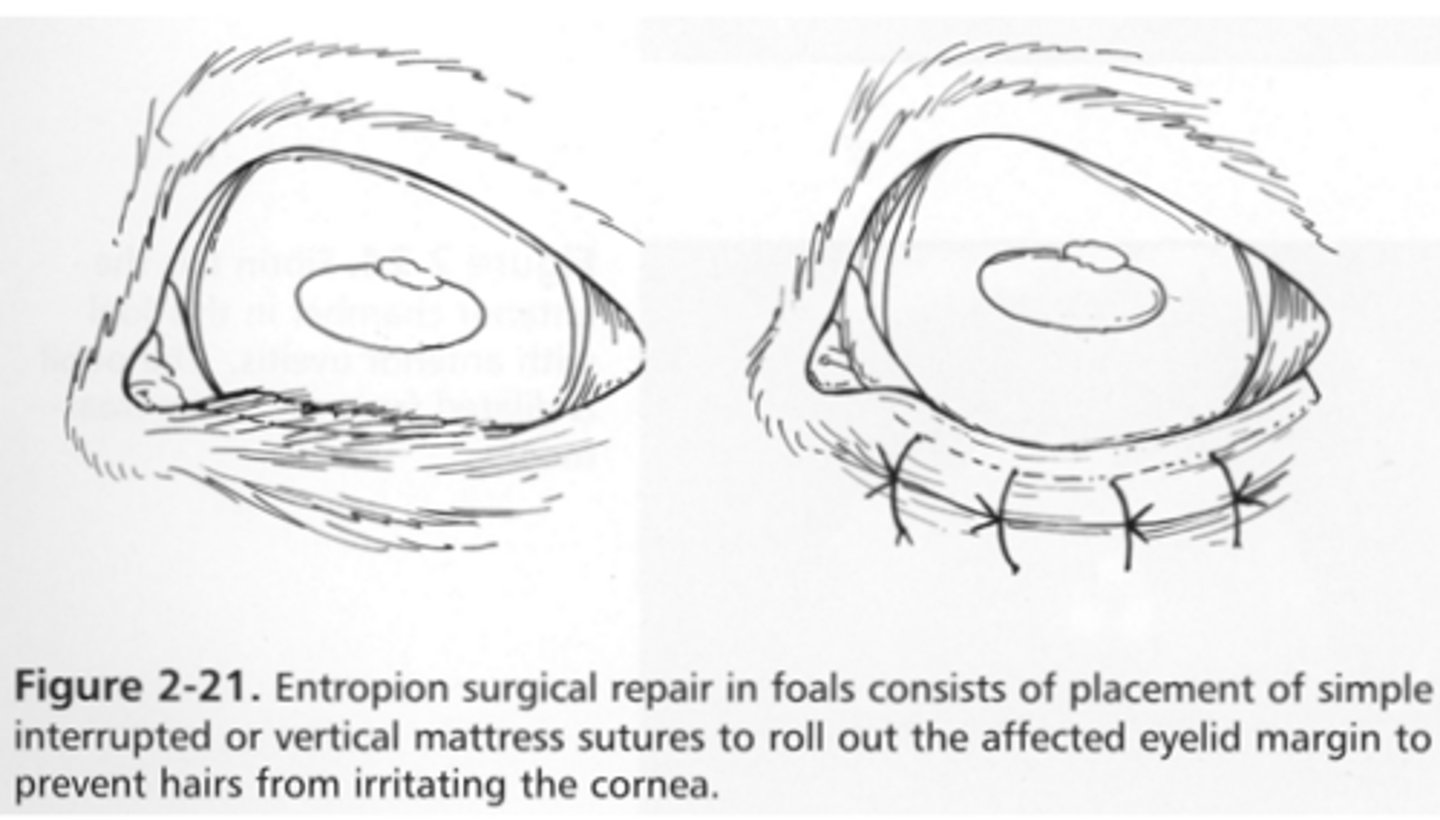 <p>- Horizontal mattress</p><p>- Simple interrupted</p>