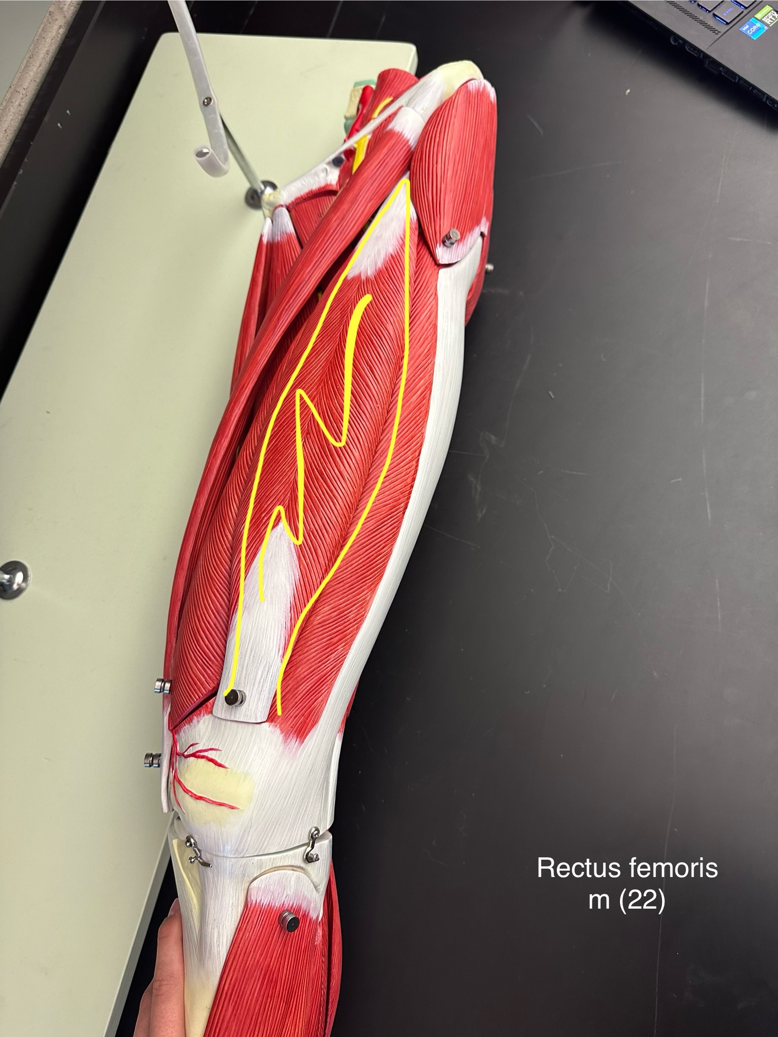 <p>Rectus femoris muscle. This muscle extends the leg and flexes the thigh at the hip.</p>