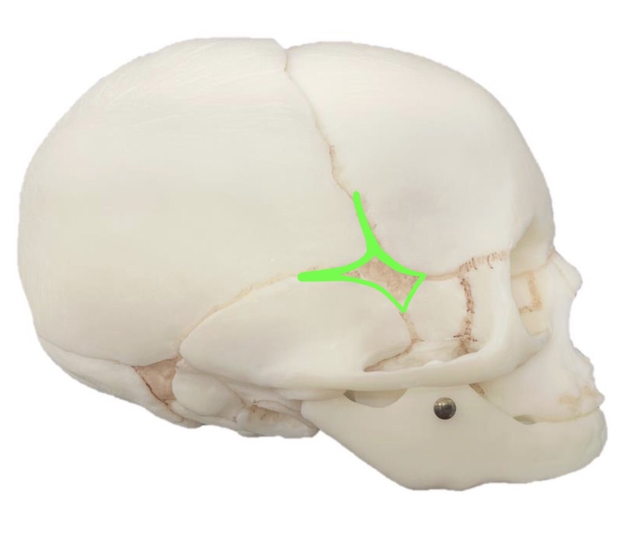 term image