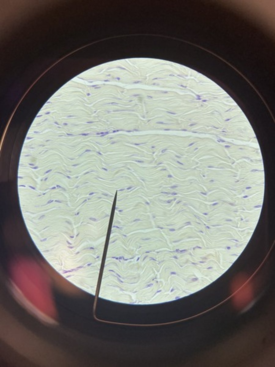 <p>collagen fibers run parallel to one another;</p><p>ligaments and tendons</p>