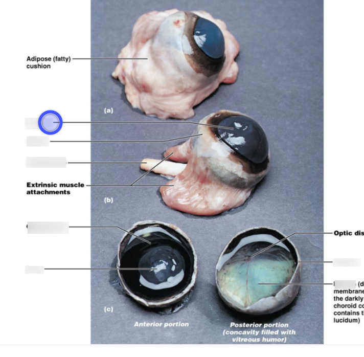 <p>cornea</p>