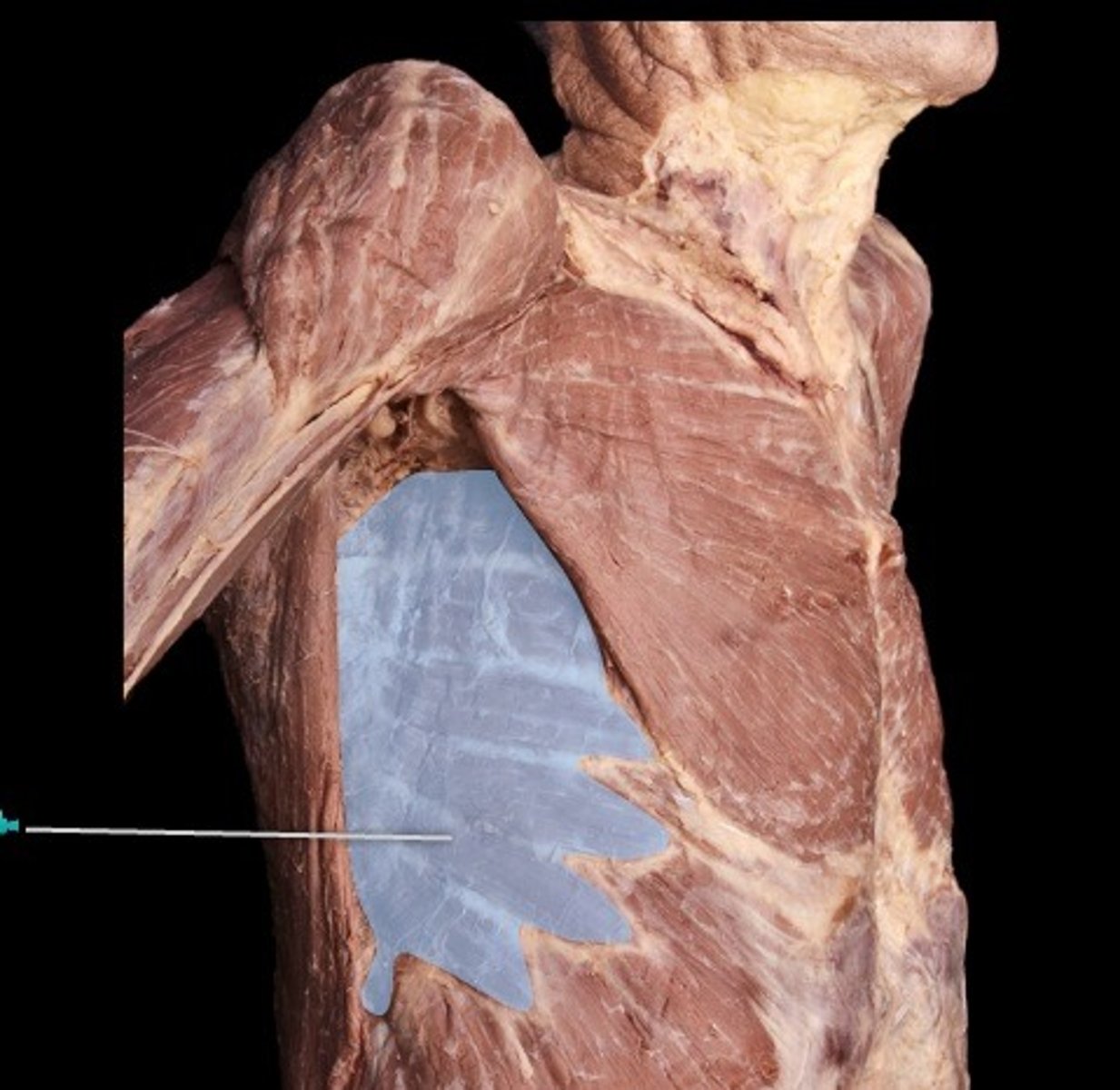 <p>What muscle is this?</p>